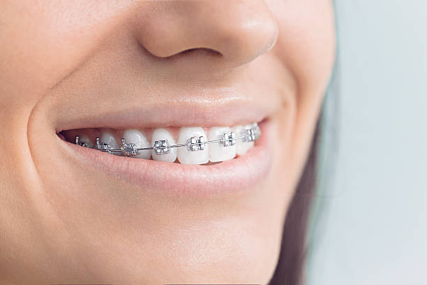 Best Teeth Whitening  in Urbana, IL